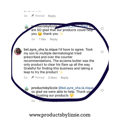 Lizzies All Natural Eczema Butter